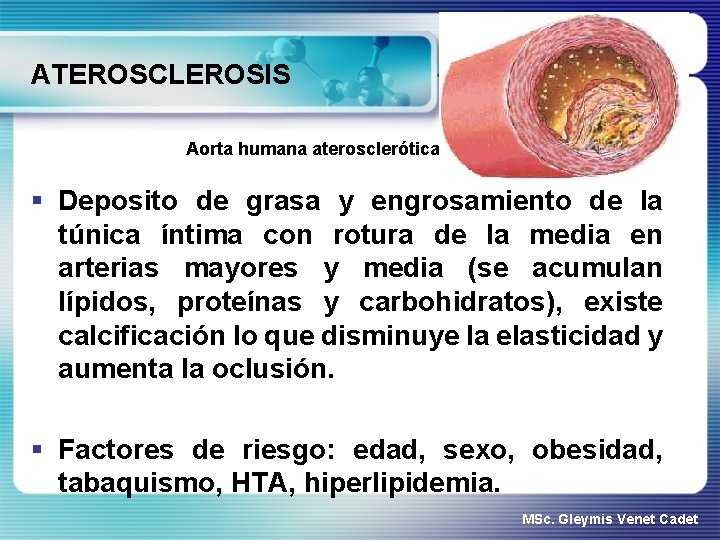 ATEROSCLEROSIS Aorta humana aterosclerótica § Deposito de grasa y engrosamiento de la túnica íntima