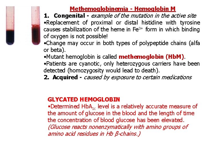 Methemoglobinemia - Hemoglobin M 1. Congenital - example of the mutation in the active