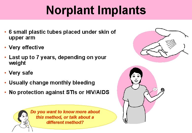 Norplant Implants • 6 small plastic tubes placed under skin of upper arm •