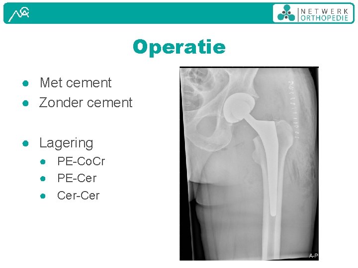 Operatie ● Met cement ● Zonder cement ● Lagering ● PE-Co. Cr ● PE-Cer