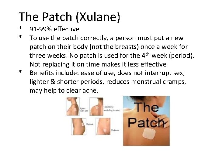 The Patch (Xulane) * * * 91 -99% effective To use the patch correctly,