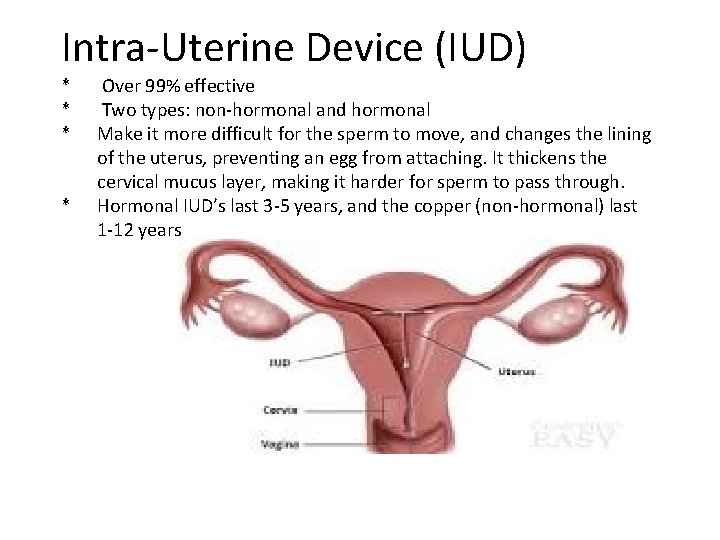 Intra-Uterine Device (IUD) * * Over 99% effective Two types: non-hormonal and hormonal Make