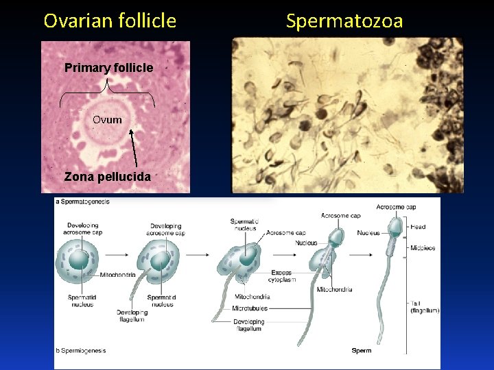 Ovarian follicle Primary follicle Ovum Zona pellucida Spermatozoa 