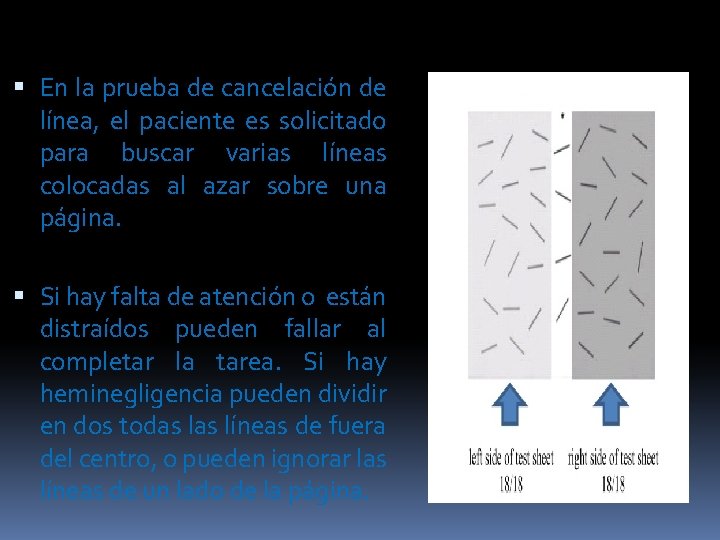  En la prueba de cancelación de línea, el paciente es solicitado para buscar