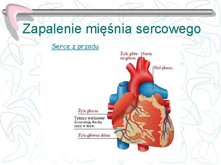 Zapalenie mięśnia sercowego 