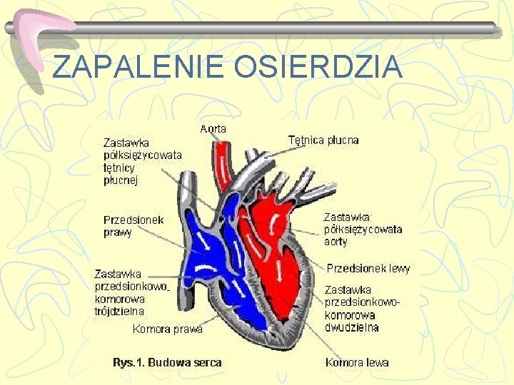 ZAPALENIE OSIERDZIA 