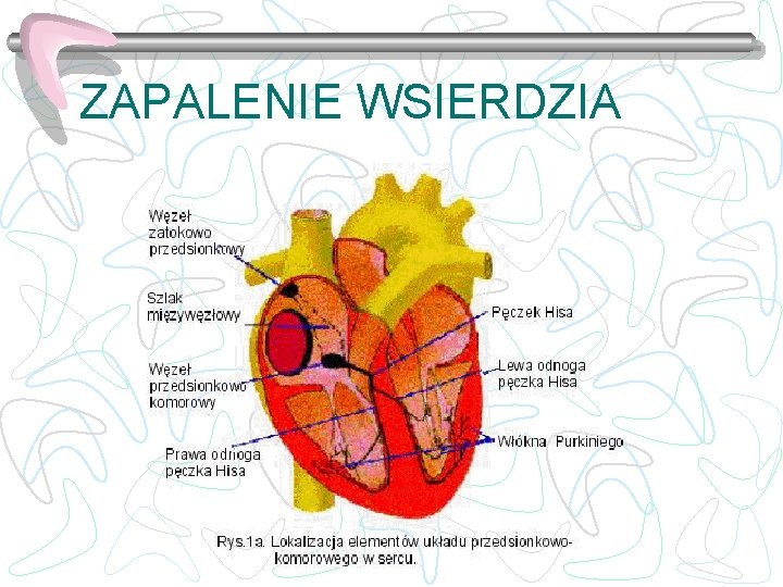 ZAPALENIE WSIERDZIA 