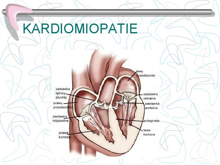 KARDIOMIOPATIE 