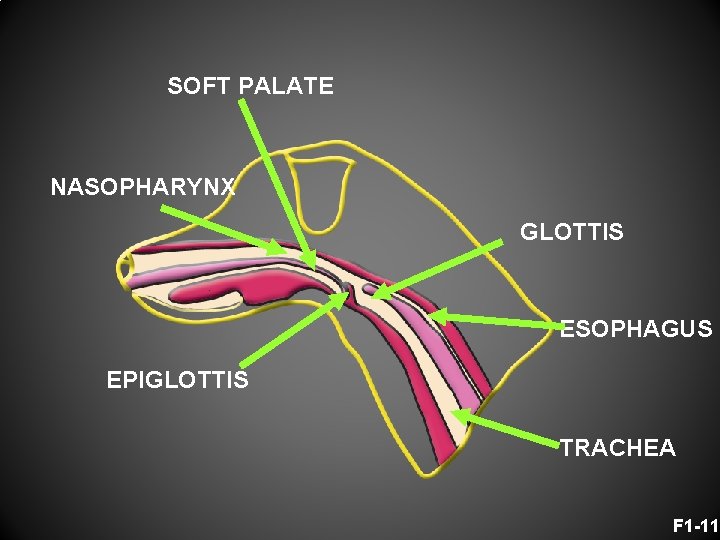 SOFT PALATE NASOPHARYNX GLOTTIS ESOPHAGUS EPIGLOTTIS TRACHEA F 1 -11 