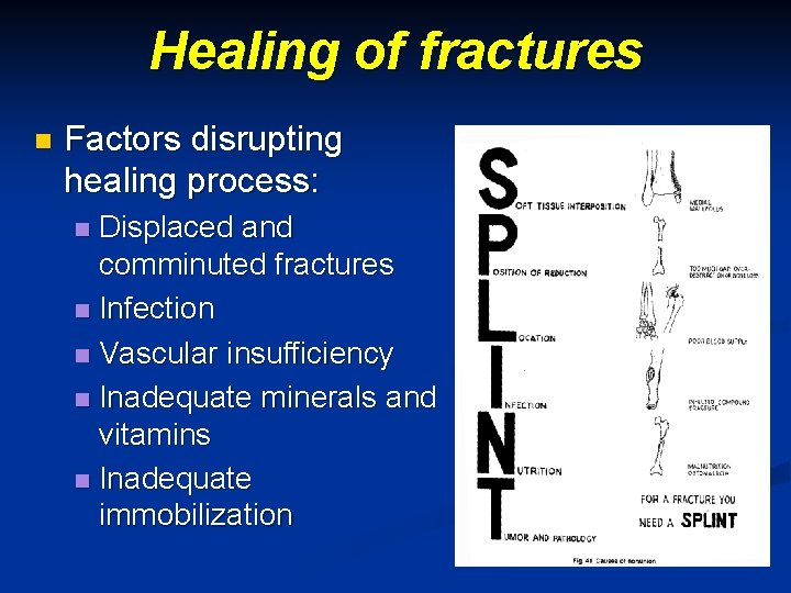 Healing of fractures n Factors disrupting healing process: Displaced and comminuted fractures n Infection