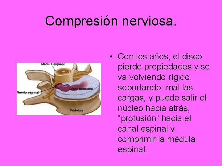 Compresión nerviosa. • Con los años, el disco pierde propiedades y se va volviendo