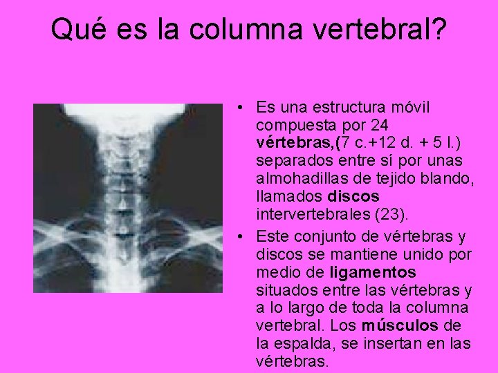 Qué es la columna vertebral? • Es una estructura móvil compuesta por 24 vértebras,