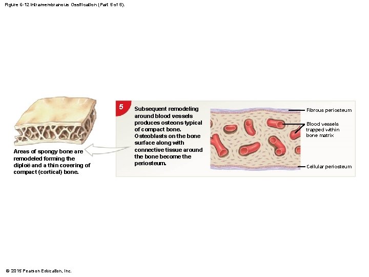 Figure 6 -12 Intramembranous Ossification (Part 5 of 5). 5 Areas of spongy bone