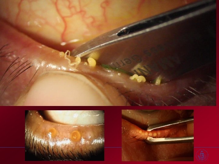 SEMMELWEIS EGYETEM SZEMÉSZETI KLINIKA 