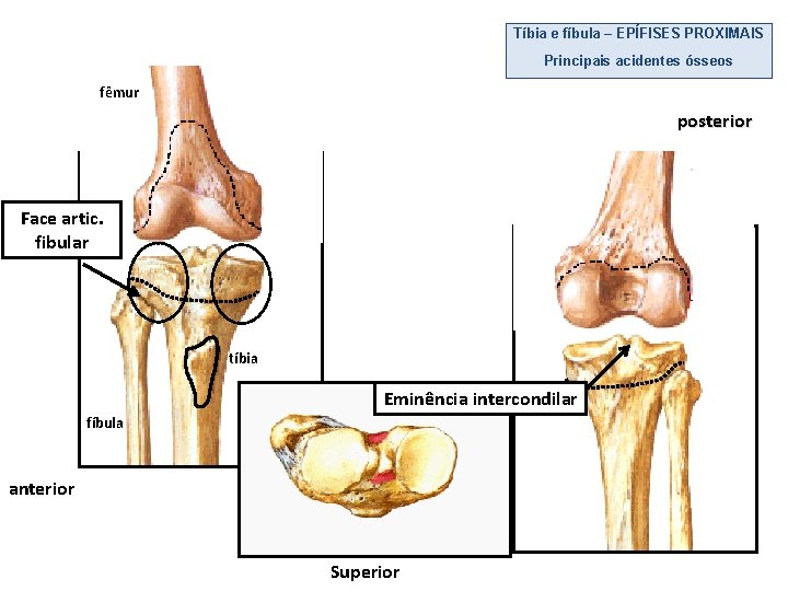 Tíbia e fíbula – EPÍFISES PROXIMAIS Principais acidentes ósseos fêmur posterior Face artic. fibular