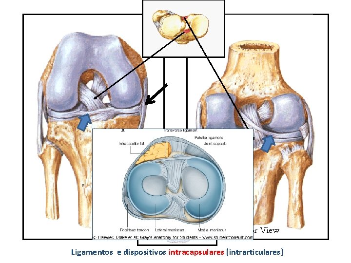 Ligamentos e dispositivos intracapsulares (intrarticulares) 