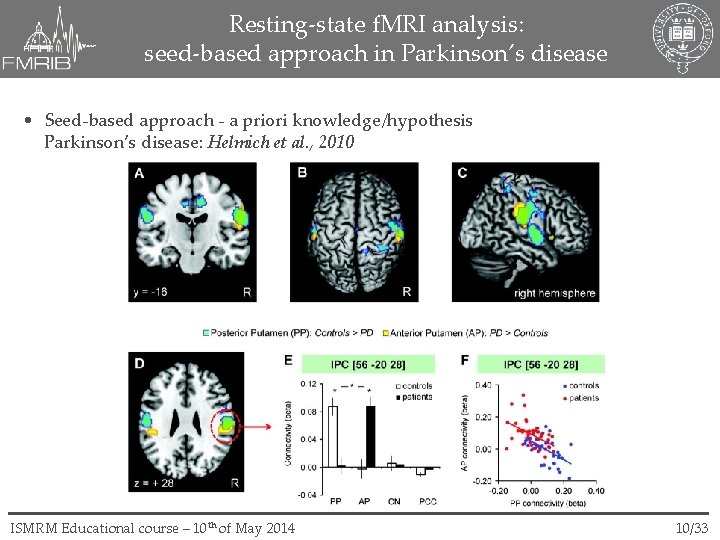 Resting-state f. MRI analysis: seed-based approach in Parkinson’s disease • Seed-based approach - a