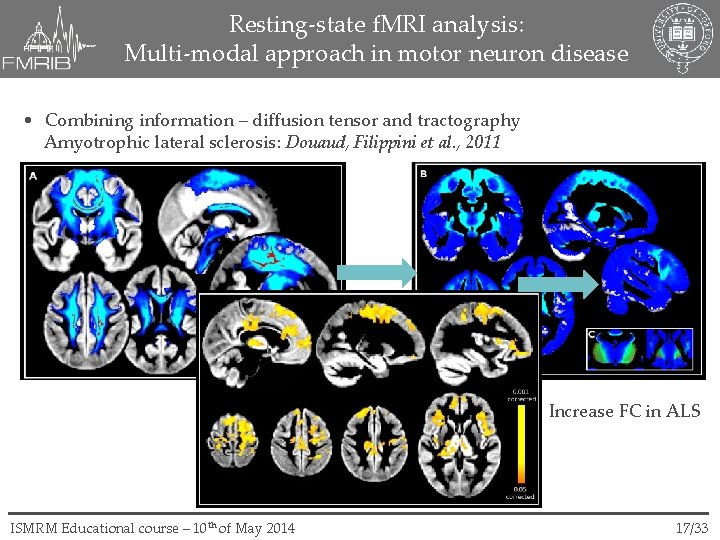 Resting-state f. MRI analysis: Multi-modal approach in motor neuron disease • Combining information –