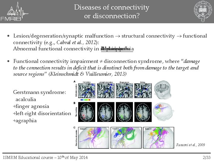 Diseases of connectivity or disconnection? • Lesion/degeneration/synaptic malfunction structural connectivity functional connectivity (e. g.