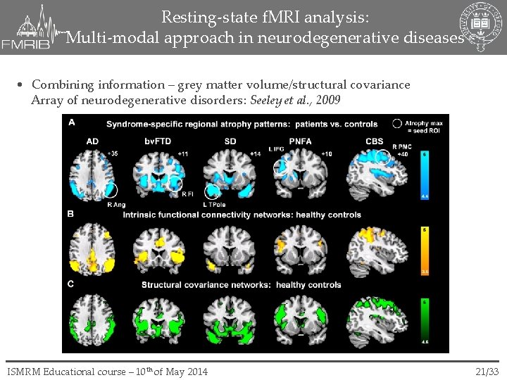 Resting-state f. MRI analysis: Multi-modal approach in neurodegenerative diseases • Combining information – grey