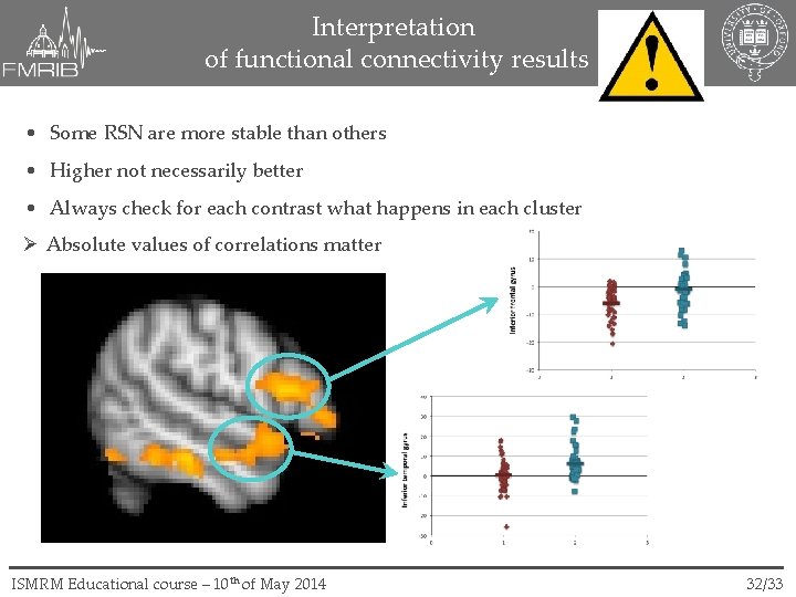 Interpretation of functional connectivity results • Some RSN are more stable than others •