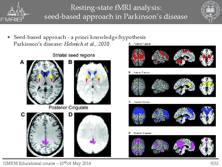 Resting-state f. MRI analysis: seed-based approach in Parkinson’s disease • Seed-based approach - a