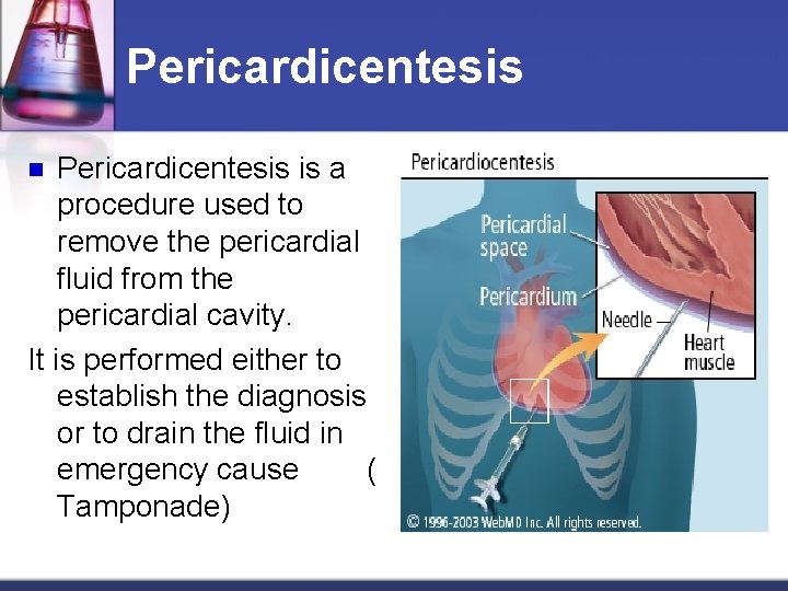 Pericardicentesis is a procedure used to remove the pericardial fluid from the pericardial cavity.