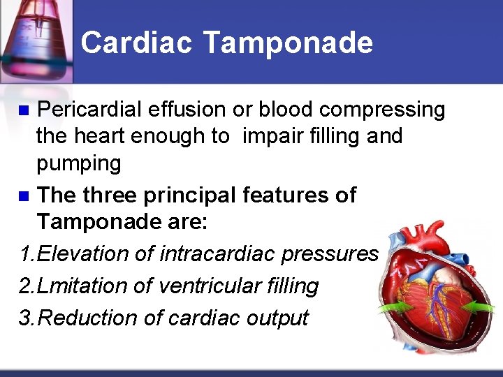 Cardiac Tamponade Pericardial effusion or blood compressing the heart enough to impair filling and