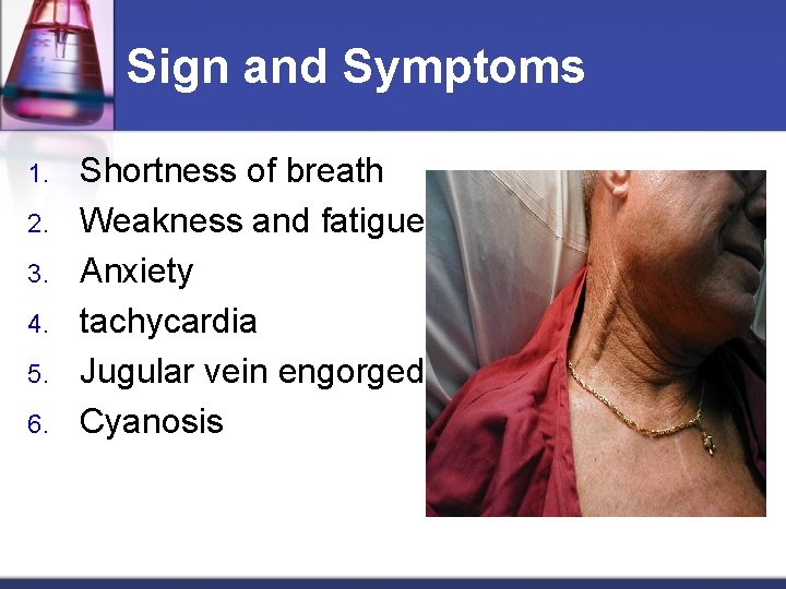 Sign and Symptoms 1. 2. 3. 4. 5. 6. Shortness of breath Weakness and