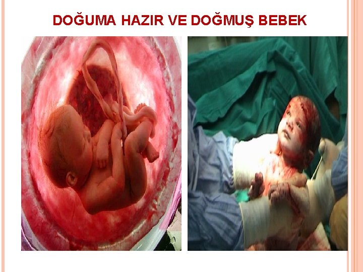 DOĞUMA HAZIR VE DOĞMUŞ BEBEK 28 