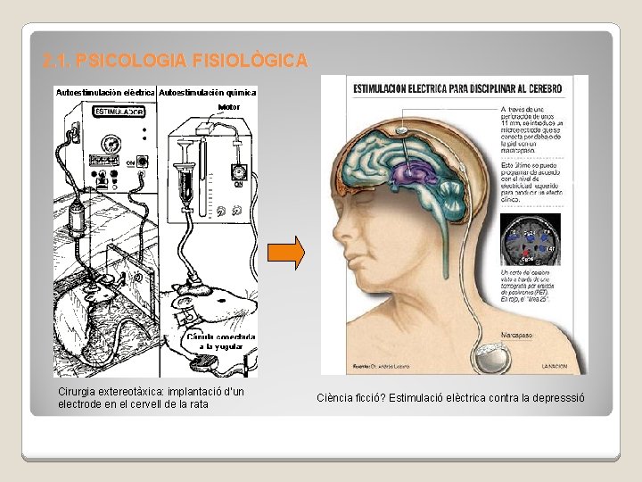 2. 1. PSICOLOGIA FISIOLÒGICA Cirurgia extereotàxica: implantació d’un electrode en el cervell de la