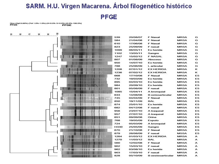 SARM. H. U. Virgen Macarena. Árbol filogenético histórico PFGE 