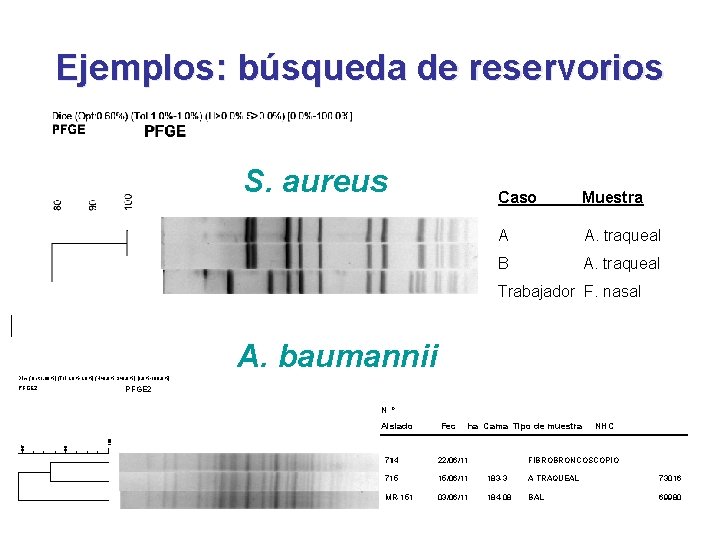 Ejemplos: búsqueda de reservorios S. aureus Caso Muestra A A. traqueal B A. traqueal