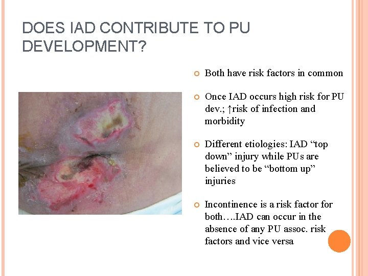 DOES IAD CONTRIBUTE TO PU DEVELOPMENT? Both have risk factors in common Once IAD