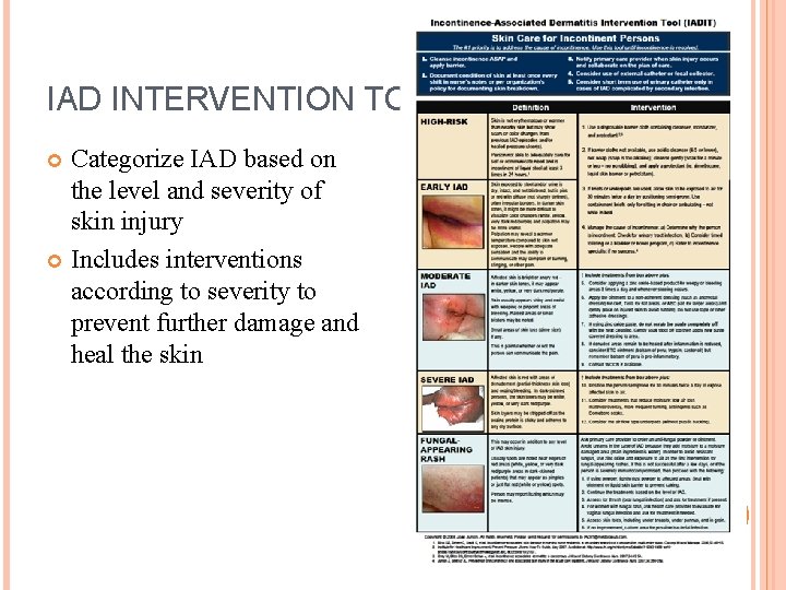 IAD INTERVENTION TOOL Categorize IAD based on the level and severity of skin injury