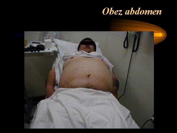 Obez abdomen 