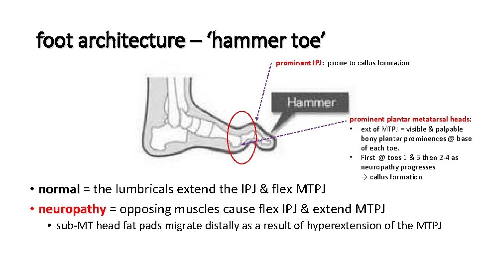 foot architecture – ‘hammer toe’ prominent IPJ: prone to callus formation prominent plantar metatarsal