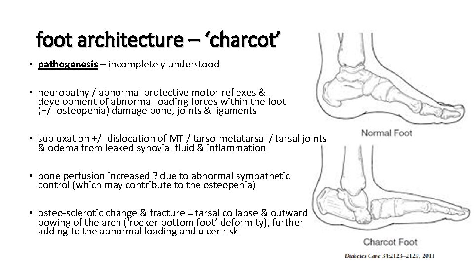 foot architecture – ‘charcot’ • pathogenesis – incompletely understood • neuropathy / abnormal protective