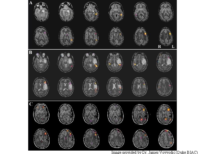Image provided by Dr. James Voyvodic (Duke BIAC) Image provided by Dr. James Voyvodic (Duke BIAC)