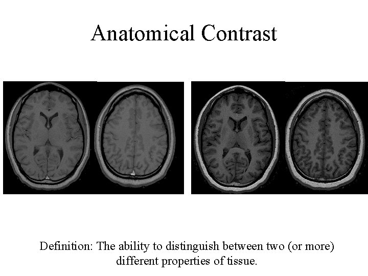 Anatomical Contrast Definition: The ability to distinguish between two (or more) different properties of Anatomical Contrast Definition: The ability to distinguish between two (or more) different properties of