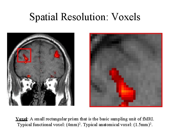 Spatial Resolution: Voxels Voxel: A small rectangular prism that is the basic sampling unit Spatial Resolution: Voxels Voxel: A small rectangular prism that is the basic sampling unit