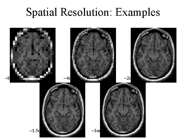 Spatial Resolution: Examples ~8 mm 2 ~4 mm 2 ~1. 5 mm 2 ~2 Spatial Resolution: Examples ~8 mm 2 ~4 mm 2 ~1. 5 mm 2 ~2