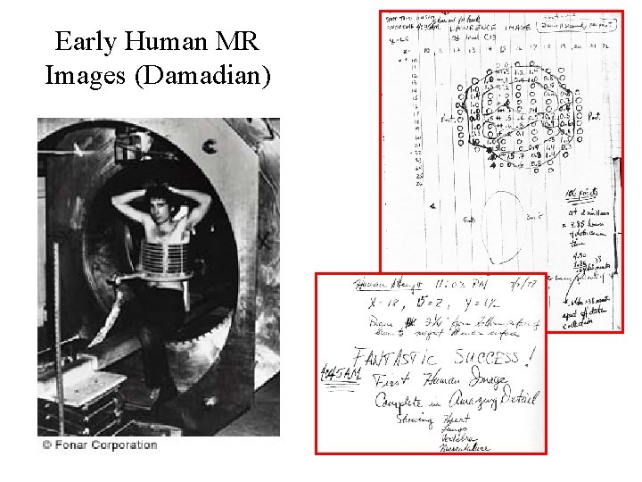 Early Human MR Images (Damadian) Early Human MR Images (Damadian)