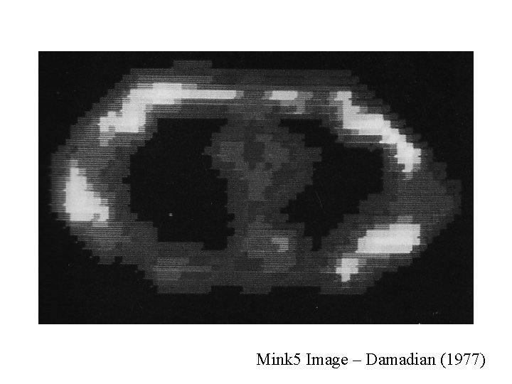 Mink 5 Image – Damadian (1977) Mink 5 Image – Damadian (1977)