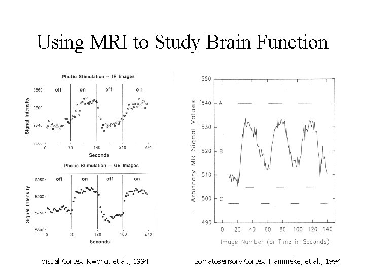 Using MRI to Study Brain Function Visual Cortex: Kwong, et al. , 1994 Somatosensory Using MRI to Study Brain Function Visual Cortex: Kwong, et al. , 1994 Somatosensory