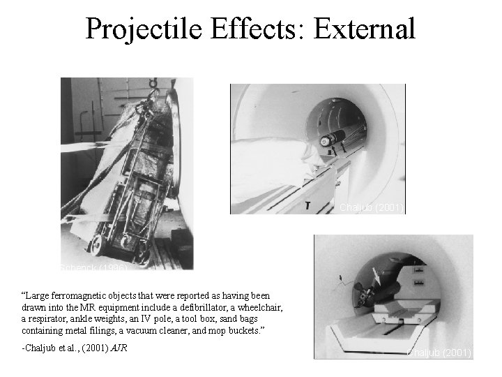 Projectile Effects: External Chaljub (2001) Schenck (1996) “Large ferromagnetic objects that were reported as Projectile Effects: External Chaljub (2001) Schenck (1996) “Large ferromagnetic objects that were reported as