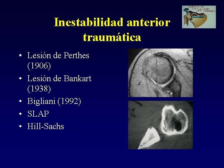 Inestabilidad anterior traumática • Lesión de Perthes (1906) • Lesión de Bankart (1938) •