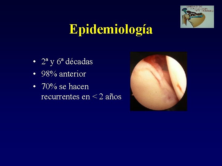 Epidemiología • 2ª y 6ª décadas • 98% anterior • 70% se hacen recurrentes