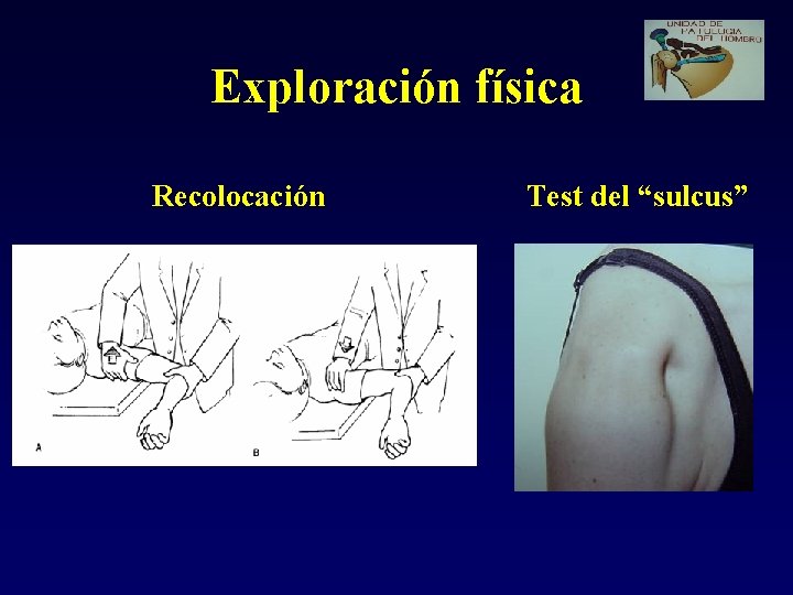 Exploración física Recolocación Test del “sulcus” 