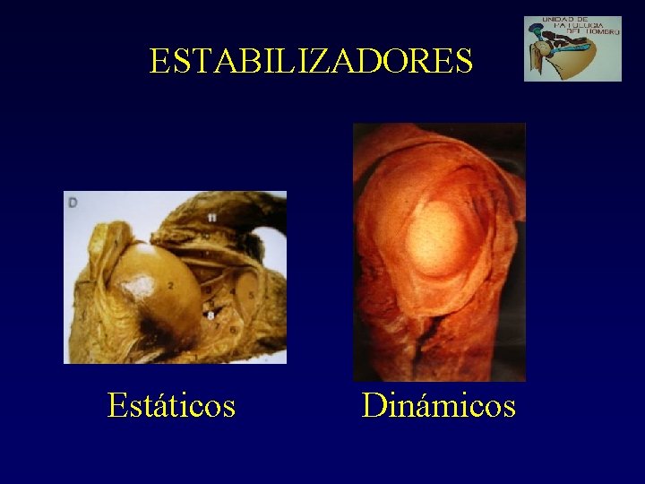 ESTABILIZADORES Estáticos Dinámicos 